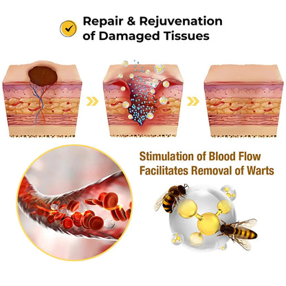 Skin Tag Remover Patch (72 Patches)